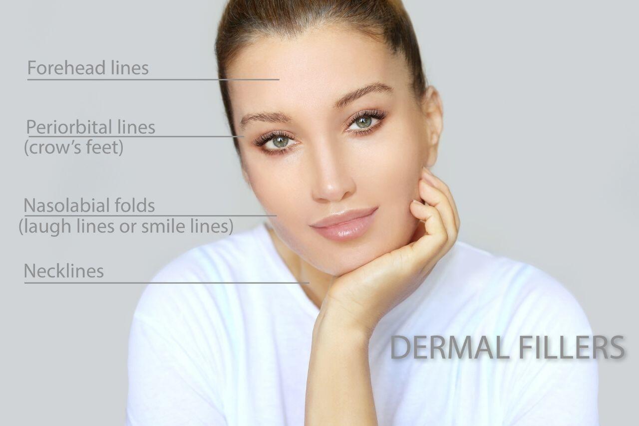 Buy Dermal Fillers Online