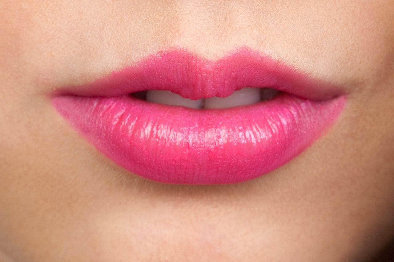 buy lip fillers online