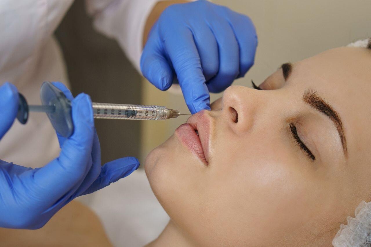 dermal fillers juvederm