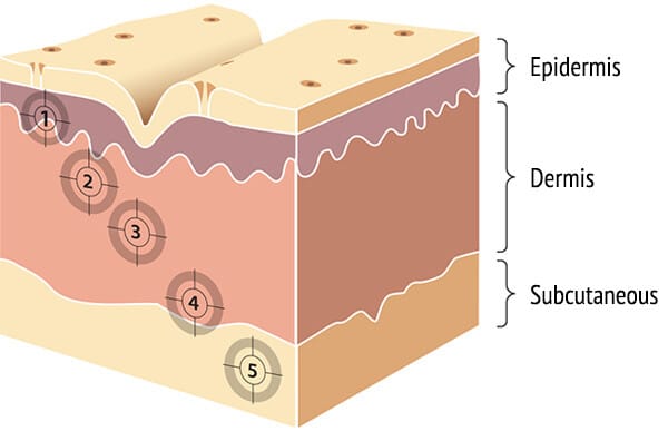 layers of the skin