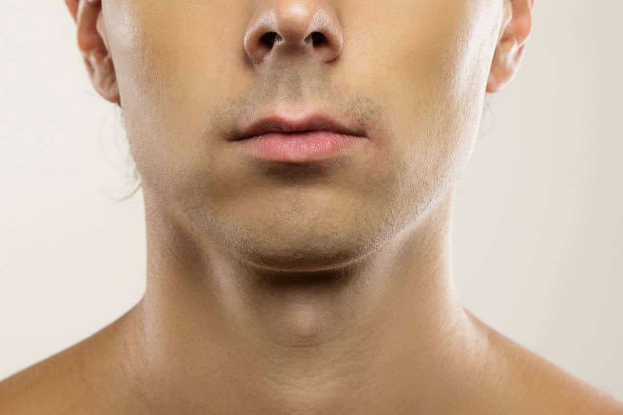 dermal fillers for contouring the male jawline