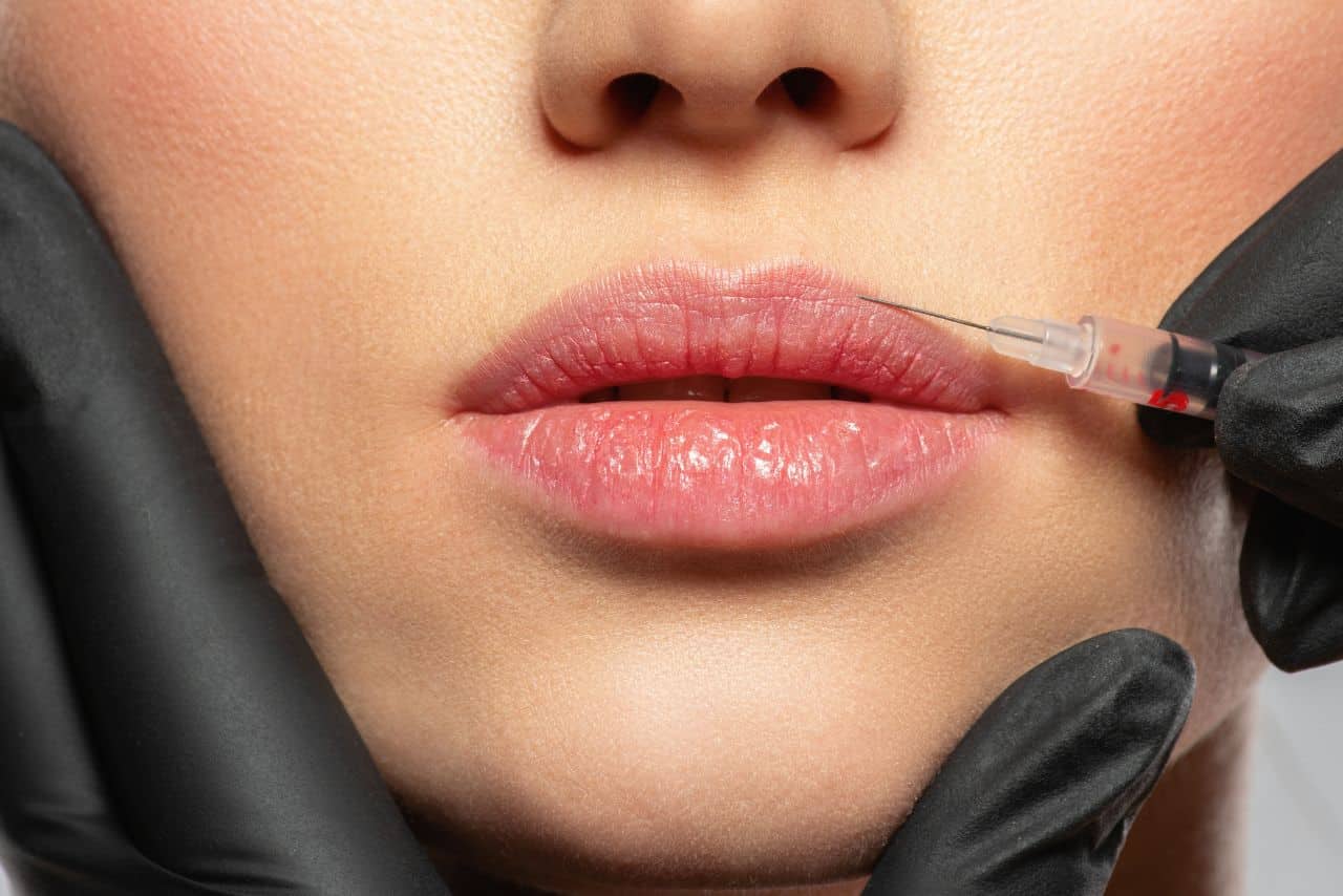 Dermal Fillers Challenges