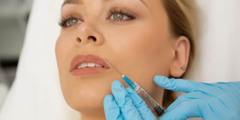 Dermal Fillers and Smile Lines