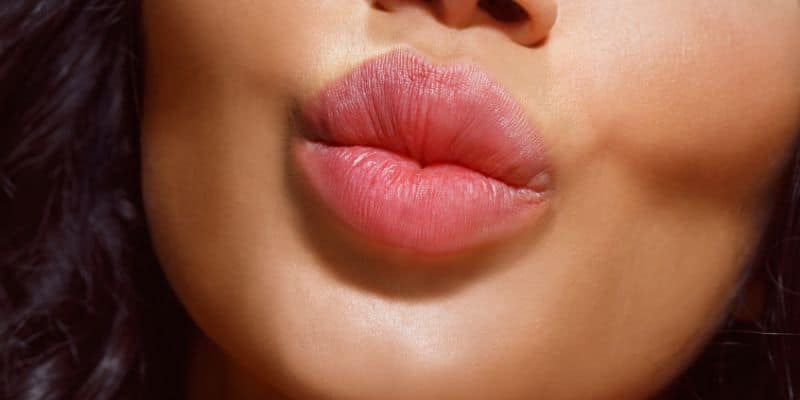 Lip filler for lip enhancement