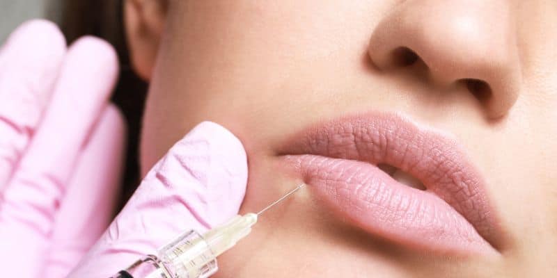 Dermalax Dermal Fillers