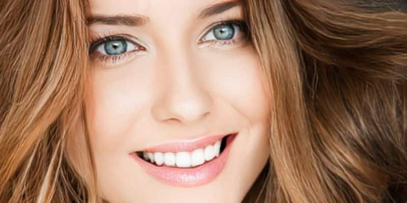 Smile Lines and Dermal Fillers