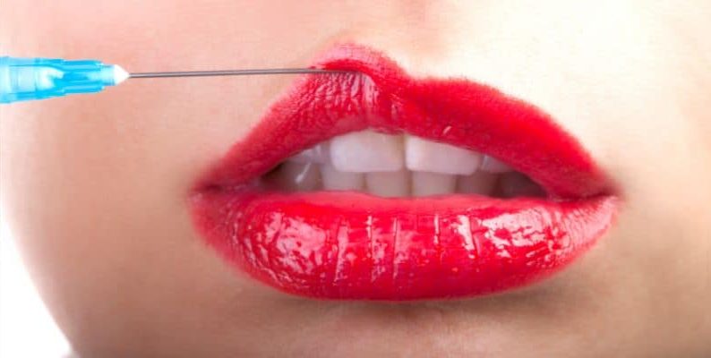 oral sex and lip fillers