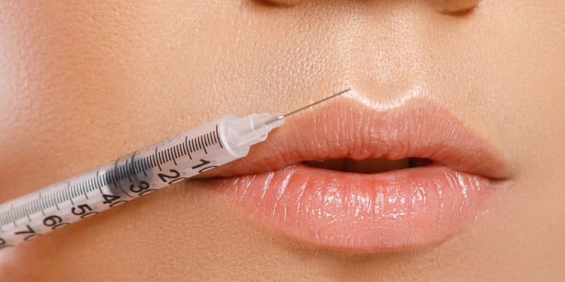 tips for lip filler recovery