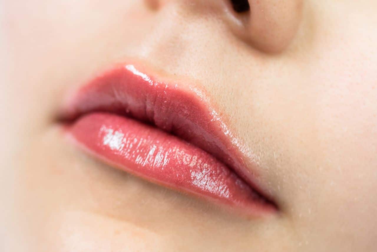 Buy Lip Fillers